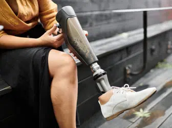 Woman with a modern prosthetic leg wearing stylish shoes outdoors.