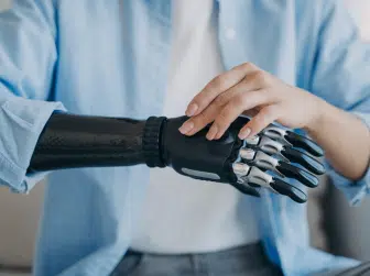 Person adjusting a high-tech prosthetic arm with advanced robotic fingers.