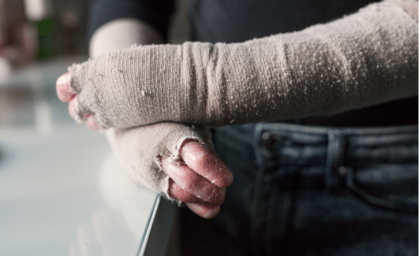Close-up of a person with bandaged hands and partial finger amputation