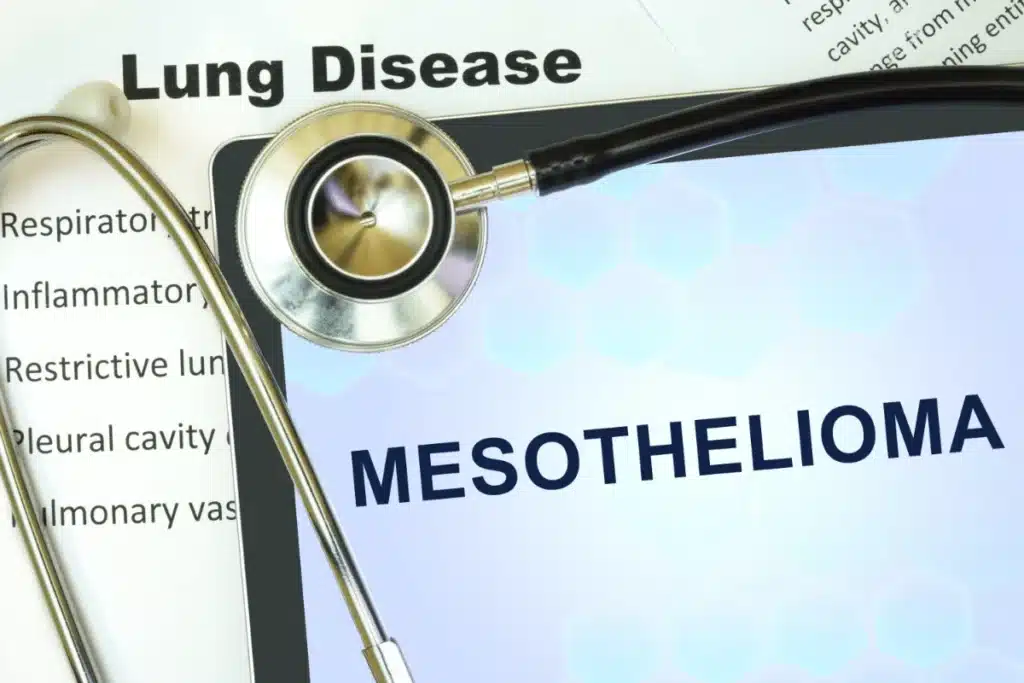 Mesothelioma text and stethoscope