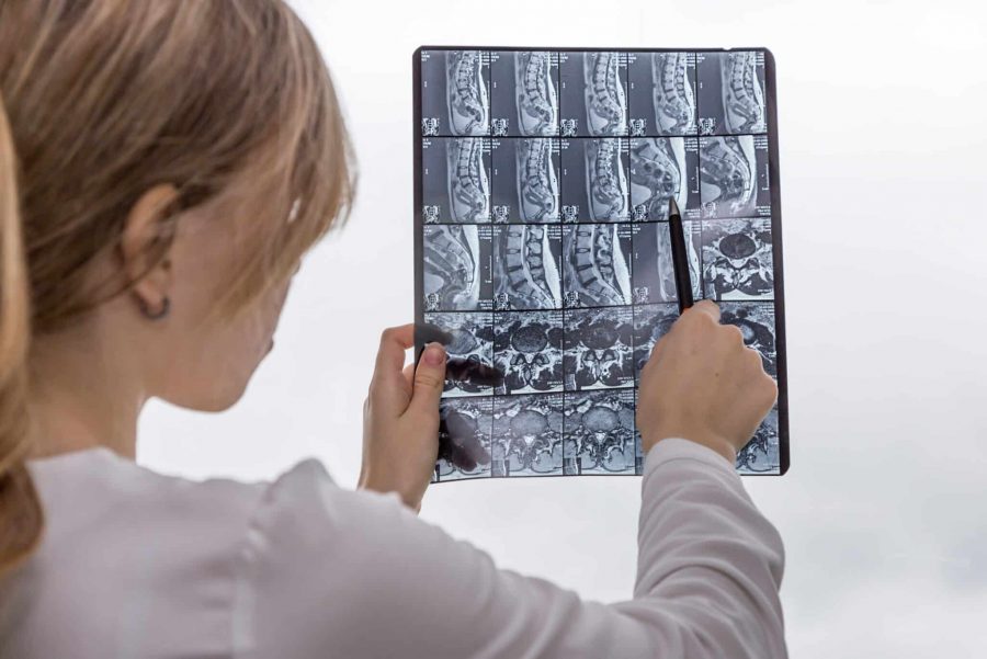 Doctor pointing to medical imaging (xRay) of spine